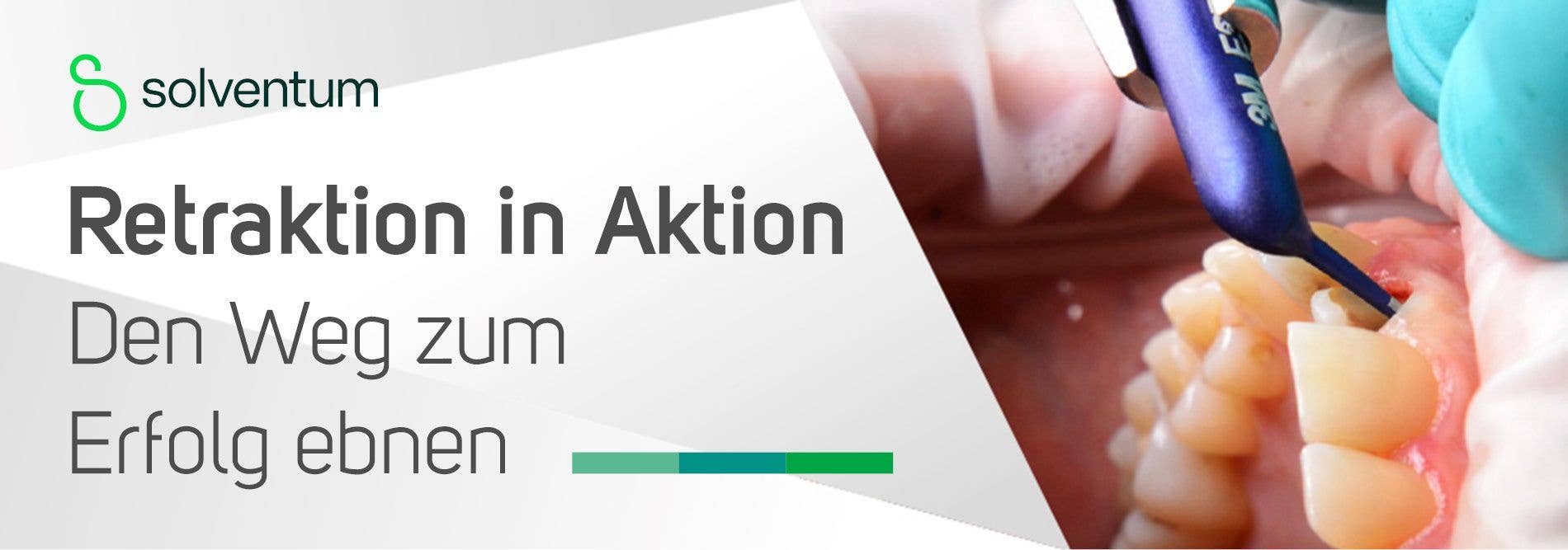 Retraktion in Aktion: Den Weg zum Erfolg ebnen