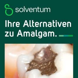 Ihre Alternativen zu Amalgam