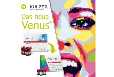 Kulzer stellt vor: das neue Venus Art Venus Pure Komposit Composite Füllungsmaterial Workflow direkte Restauration vereinfachen